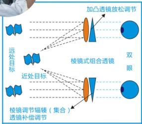 旧近视镜片回收