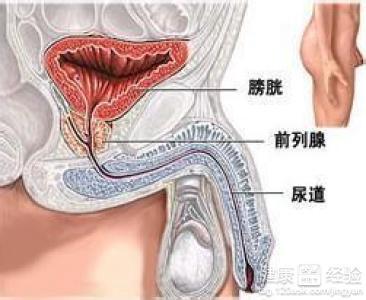 前列腺钙化怎么治疗最有效果