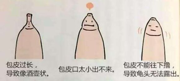 哪里的医院好小儿斜颈